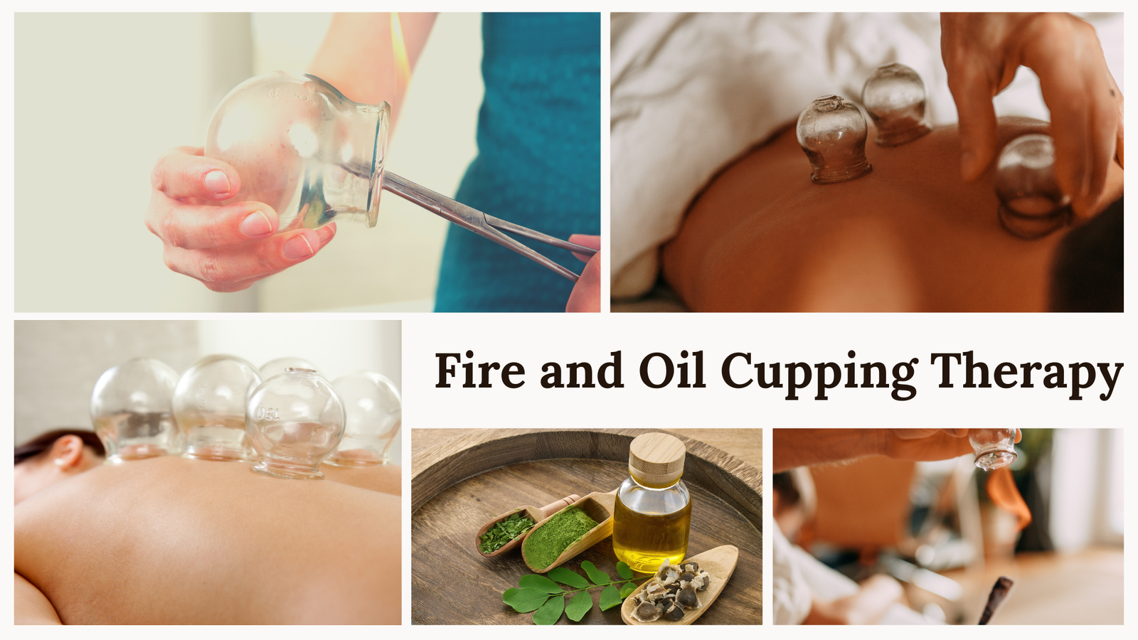 Fire and Oil Cupping Therapy
