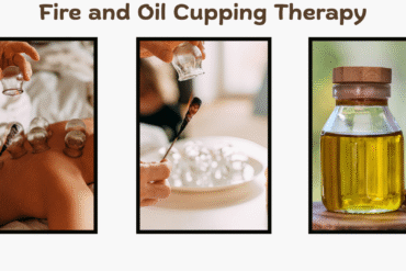 Fire and Oil Cupping Therapy