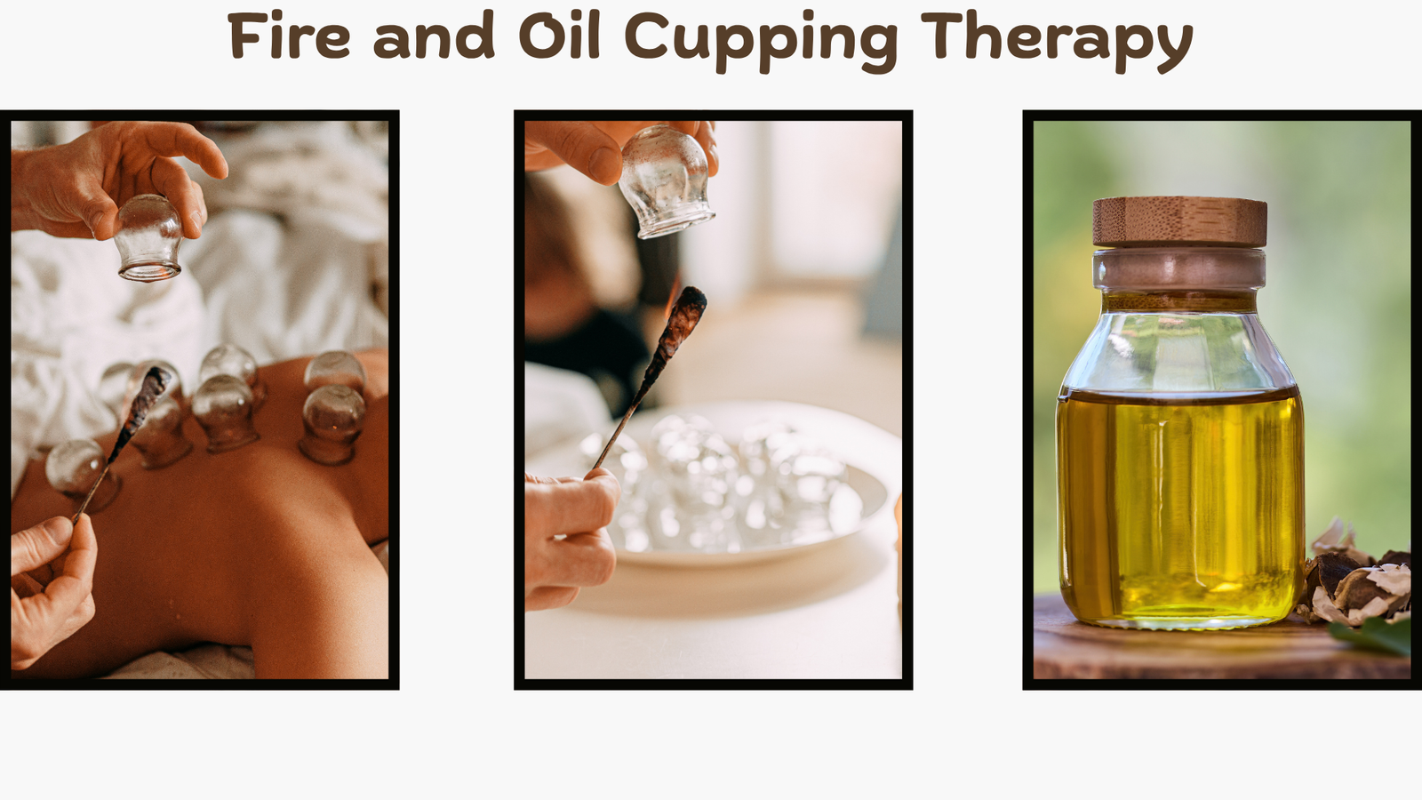 Fire and Oil Cupping Therapy